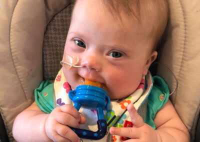 Adapted Baby-Led Weaning for Babies with Feeding Challenges
